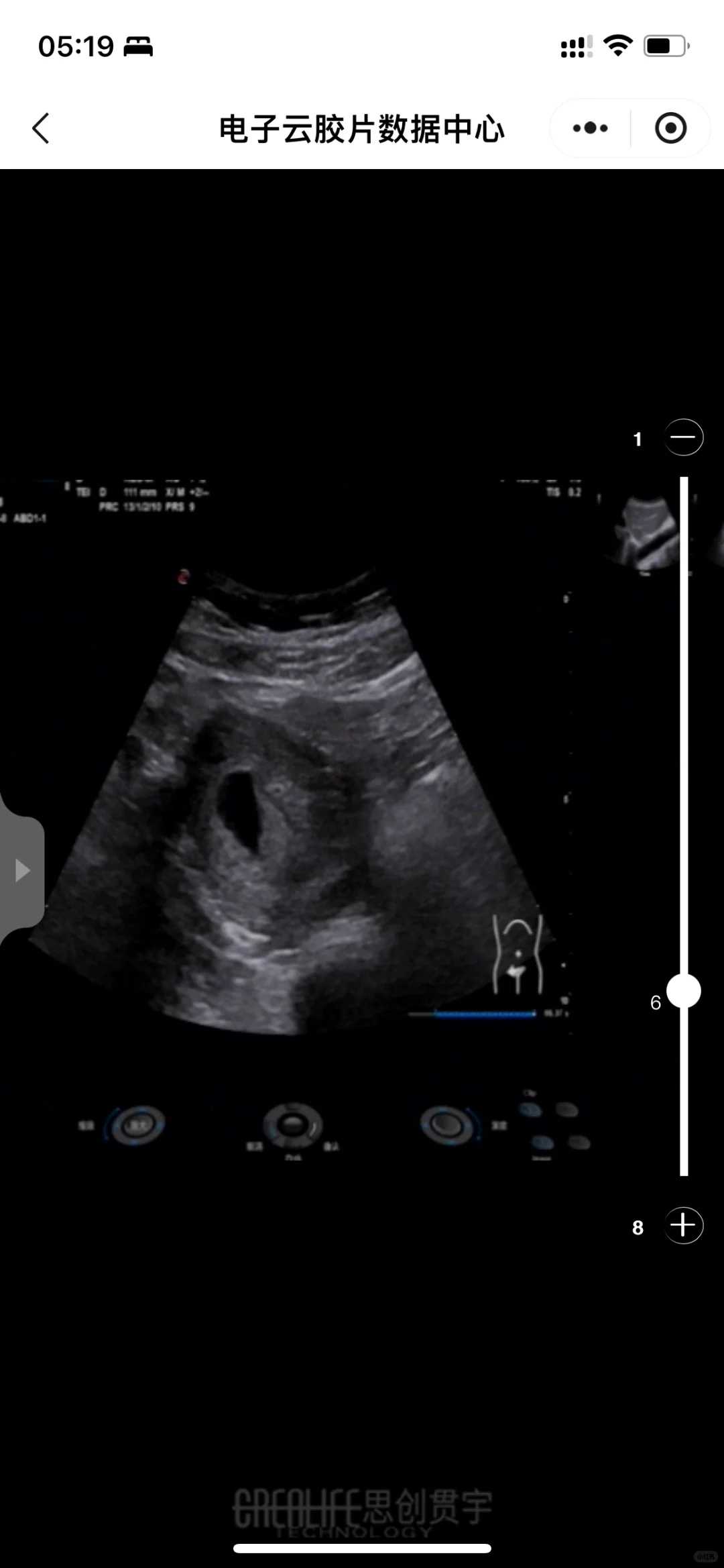 找北京代怀,北京做供卵代孕需要花费多少钱